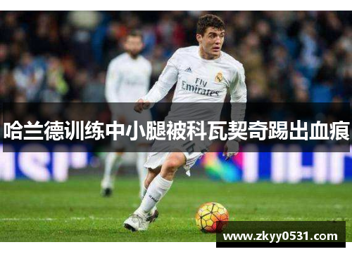 哈兰德训练中小腿被科瓦契奇踢出血痕